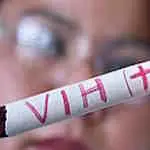 Первые симптомы заражения ВИЧ